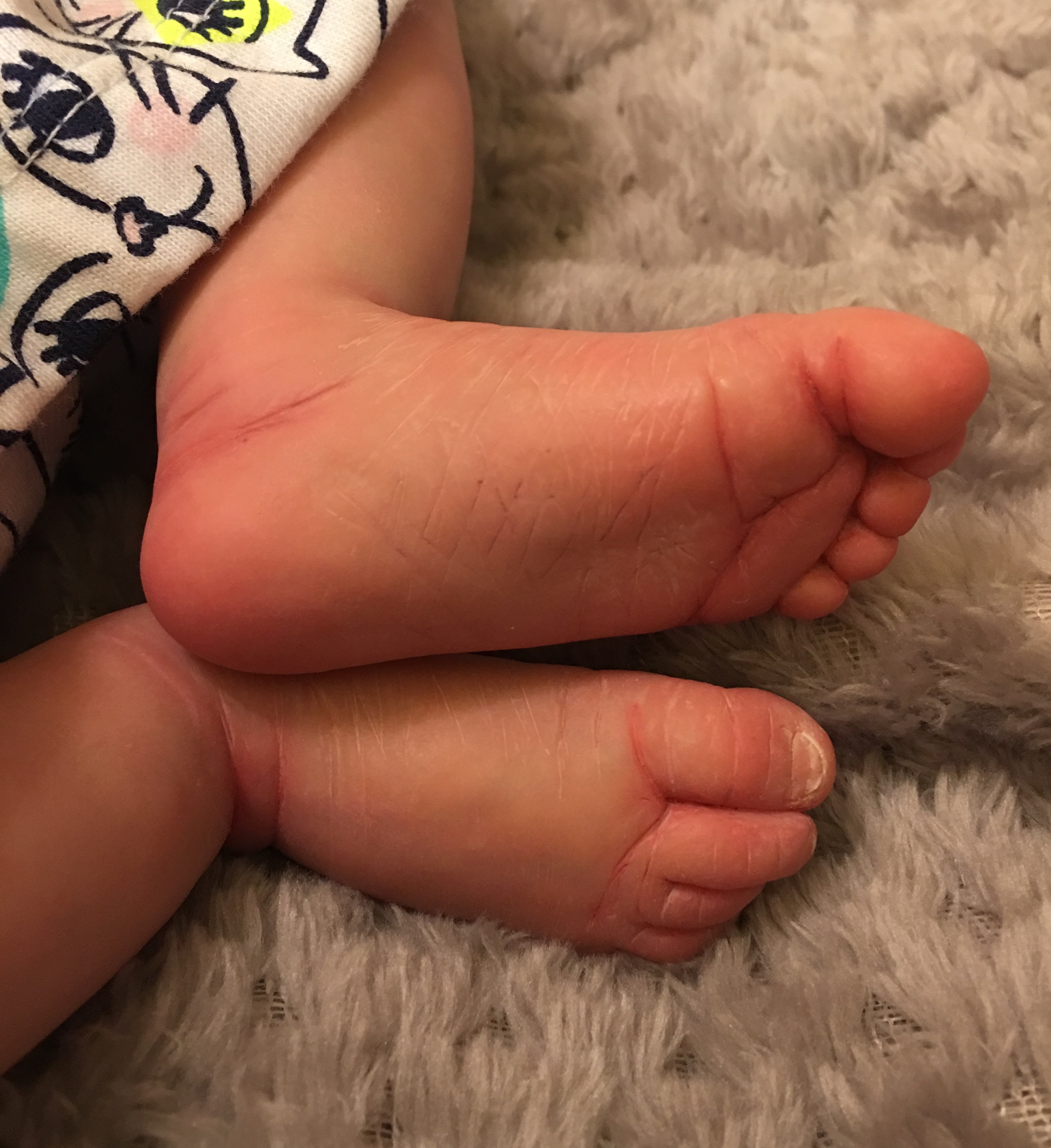 Scarlett's feet