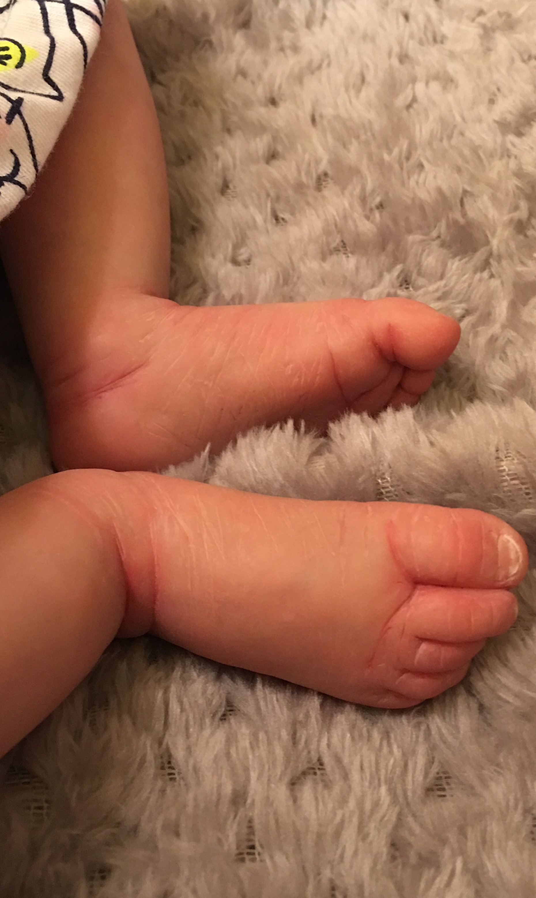 Scarlett's feet2
