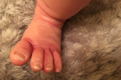 Summer Rain's Foot